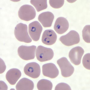 Giemsa-stained thin blood film under oil immersion